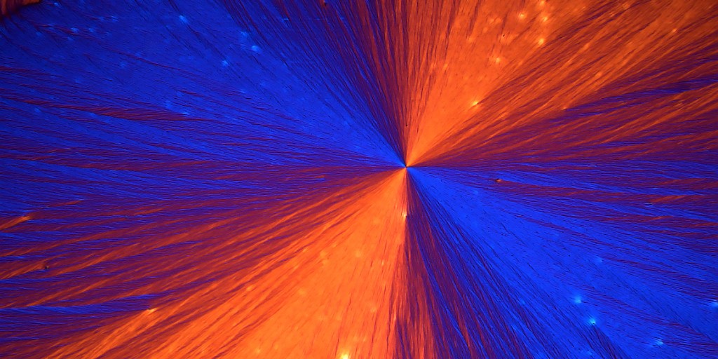 MoticAmericas's tweet photo. Vitamin C crystals in polarized light and the Moticam ProS5 Lite camera 100 X using the Motic BA310 Polarizing microscope.
Shop our Moticam ProS5 lite here: https://t.co/k6dp5kDnuo
🎥: Dr. Robert Berdan
#motic #moticam #vitaminc #crystals #cell #researcher https://t.co/eNhuziXWPa