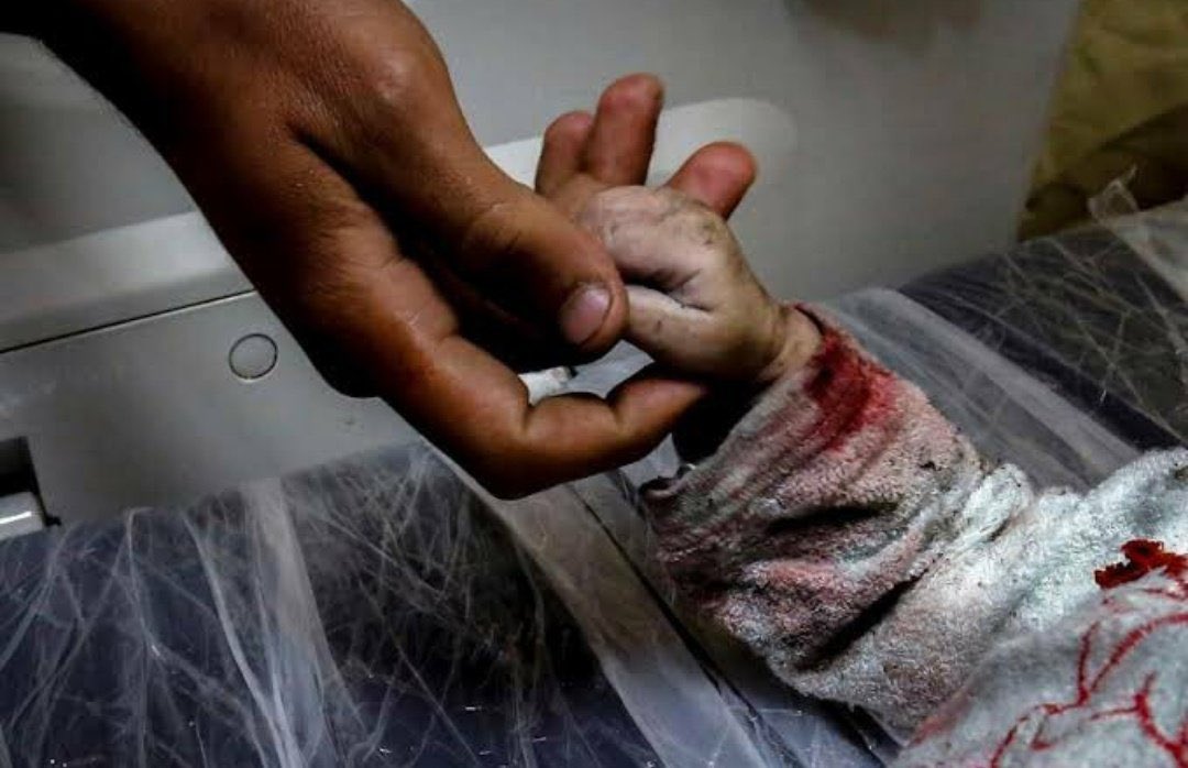 BAYRAMIN MÜBAREK OLSUN YAVRUM
...
Gazze’de babalar çocuklarının elini öper bayramda.
Şekerini, çukulatasını toprağa gömer.
...
#HearGaza