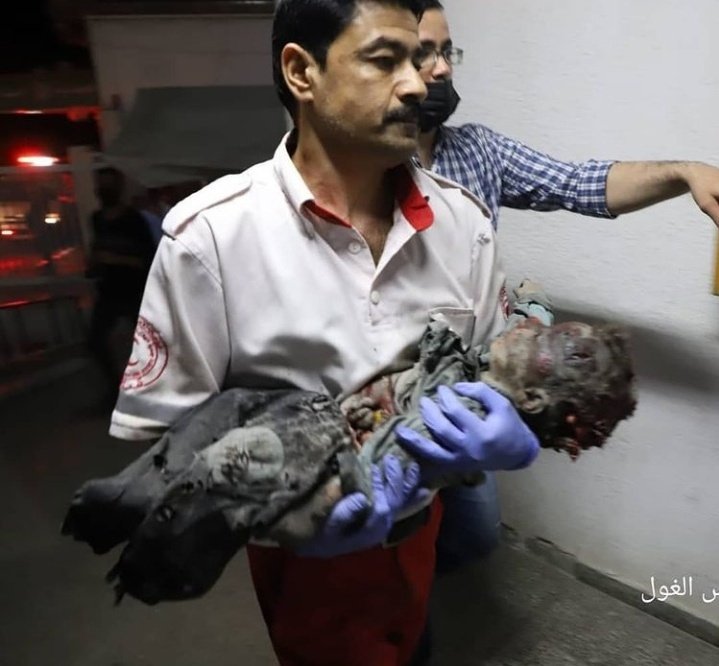 IzuIsar's tweet photo. Some People Don't Believe in Palestinians!! Because The World Human Rights Defenders of The World are Still Not Talking! They're Still Not Saying Anything! But Everyone Who is Human Must Stop This Cruelty! All People Around The World Have To Learn That Genocide!!
#GenocideinGaza https://t.co/Lz8v4ES1Ij