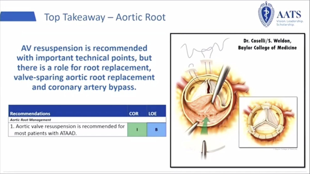 Joseph Coselli, MD (@jcoselli_md) on Twitter photo Thank you to <a href="/ChrisMalaisrie/">S Chris Malaisrie</a> for highlighting important takeaways from the new 2021 AATS Expert Consensus Document for ATAAD.
Special shoutout to <a href="/Scott_A_Weldon/">Scott Weldon</a> for creating the great artwork. Thank you to <a href="/ChrisMalaisrie/">S Chris Malaisrie</a> for highlighting important takeaways from the new 2021 AATS Expert Consensus Document for ATAAD.
Special shoutout to <a href="/Scott_A_Weldon/">Scott Weldon</a> for creating the great artwork.