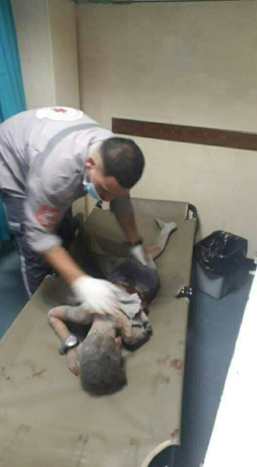 مشاهد  رعب ! 
Unbelievable crime! 
#Gaza_Under_Attack 
#IsraeliTerrorism