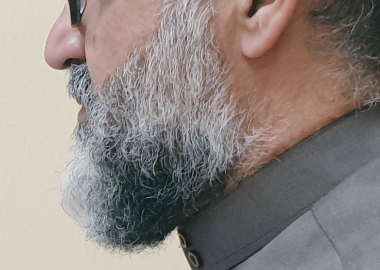 الشيب دليل الضعف والكِبَر، ورسول الموت، ونذيره، فتوسل إلى الله تعالى بضعفه وعجزه، وهذا من أحب الوسائل إلى الله، لأنه يدل على تعلق القلب بحول الله وقوته.
السعدي
( قَالَ رَبِّ إِنِّي وَهَنَ الْعَظْمُ مِنِّي وَاشْتَعَلَ الرَّأْسُ شَيْبًا وَلَمْ أَكُن بِدُعَائِكَ رَبِّ شَقِيًّا ).