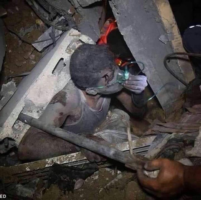 mshinqiti's tweet photo. This is the face of the Israeli savagery in #Gaza American and European politicians don’t want you to see.  No apology for the pictures. The reality is more brutal..
#GenocideinGaza 
#GazaUnderAttack
#IsraelTerrorist https://t.co/nEVw8f3Fzv