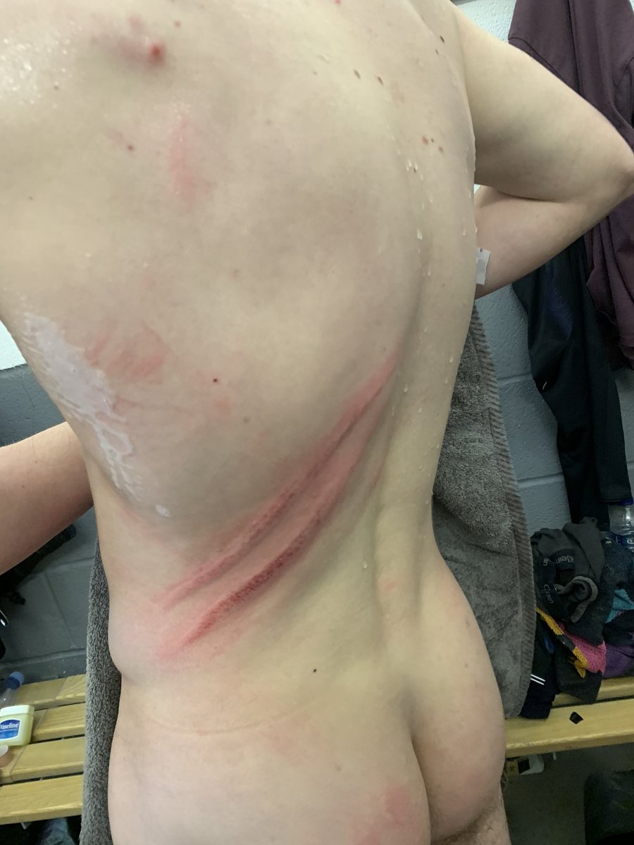 Callum Fry tweet media