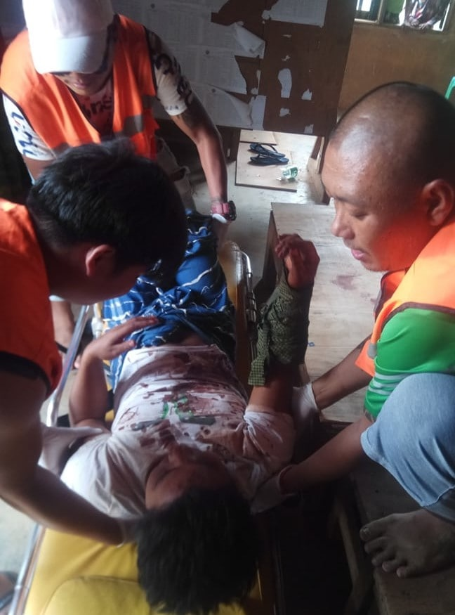 spring21MM's tweet photo. Tw\\ blood,gunshot
Two men who returned from their work were unjustly shot and wounded after being chased &amp; shot by Military terrorists on the night of May 21 in #Kyaukme, N.Shan State.
-It's learned that one was taken to hospital this morning.
#May22Coup
#WhatsHappeningInMyanmar https://t.co/KPbFjscF3R