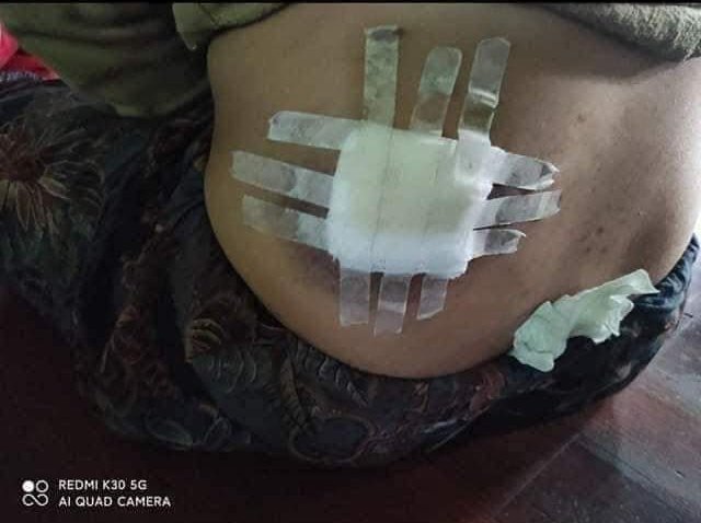Pay attention to MinDat City, Chin State. All of the SAC atrocities committed against civilians in Mindatt r beyond the pale. It could be another genocide against Chin ethnics if the world is still closing its ears n eyes to injustice.
#NoFlyZoneInMyanmar
#HumansAreNotShields