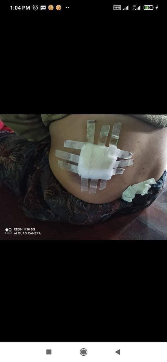 Pay attention to MinDatt City, Chin State. All of the SAC atrocities committed against civilians in Mindatt r beyond the pale. It could be another genocide against Chin ethnics if the world is still closing its ears n eyes to injustice.

#May15Coup 
#WhatsHappeningInMyanmar