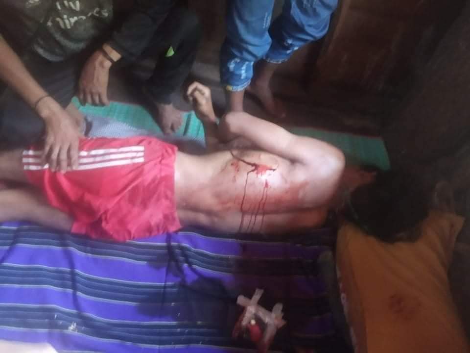 Tw // Blood
In #Mindat, some homes were destroyed and some innocent people were injured as Junta terrorists opened fire with heavy weapons.
#May15Coup
#WhatsHappeningInMyanmar
#MilkTeaAlliance https://t.co/Y3mXVm9f2Y