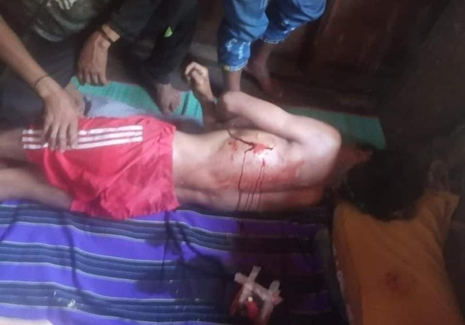 therealyatioo's tweet photo. ❗WAR CRIME ALERT ❗
Today, Military Junta (SAC) is attacking the small town of #Mindat in Chin State with airstrikes, artillery shells and RPGs, and is using innocent detainees as " Human Shields. " 
#May15Coup
#NoFlyZoneInMyanmar
#HumansAreNoteShields
#WhatsHappeningInMyanmar https://t.co/DNC3aXo7j5