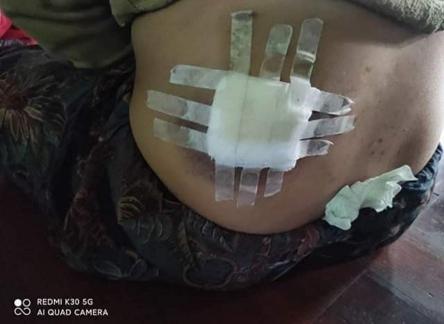 Thu_Rein_Win's tweet photo. Unofficial Military arrested many people in today. Detainees are being used as protection in Mindat city. They are using attacking by strong weapons, snipers, cannon and tank car.

#HelpMindat
#NoFlyZoneInMyanmar
#HumansAreNotShields https://t.co/EbqWCxcxz0