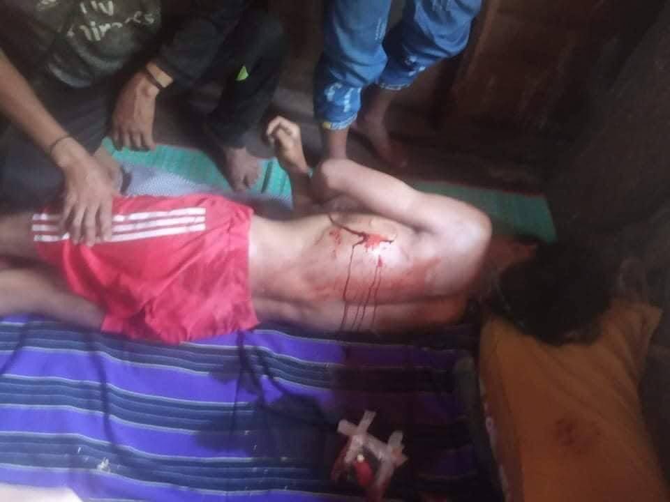 Tw // blood
#MinDat is being attacked with heavy weapons and helicopters since morning. Many got injured reportedly. World, help us by setting #NoFlyZoneInMyanmar.  #May15Coup  #WhatsHappeningInMyanmar