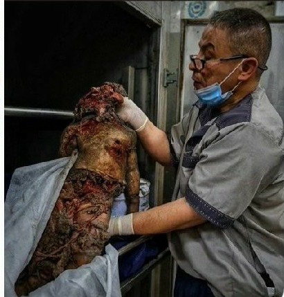 Muhammadaklouk's tweet photo. @AlarabyTV للنشر هذا ما تفعله العصابات الإجرامية الصهيونية ضد أبناء الشعب الفلسطيني https://t.co/KTrmyEONtp