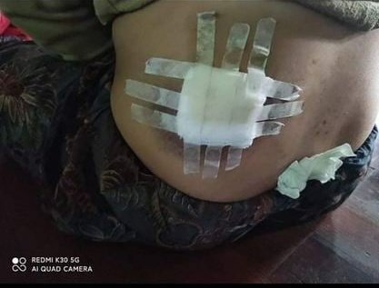 BBH_myanmar's tweet photo. Every man in #Mindat is being arrested! Minors were also injured and did not receive medical treatment! What is happening in Mindat is no different from genocide! 

#HelpMinDat #HumansAreNotShields #NoFlyZoneInMyanmar 
#WhatsHappeningInMyanmar https://t.co/H7x6aiS2qR