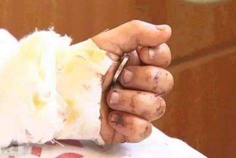 تبا لمن سرق أحلام العصافير 💔
#GazaUnderAttak
#Gaza_Under_Attack