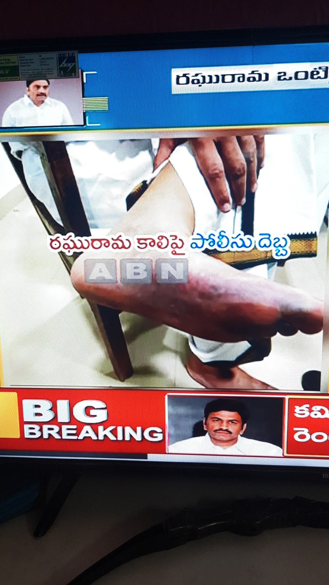 Dwarakanatht's tweet photo. Dear @dgpapofficial sir, who the hell gave you people right to beat an MP @RaghuRaju_MP in the name of enquiry? Do we have rule of law in ap?
#NoRuleofLawinAP
#AtrocityofAP_CID
#ResignJagan https://t.co/Kr8sLW11JI