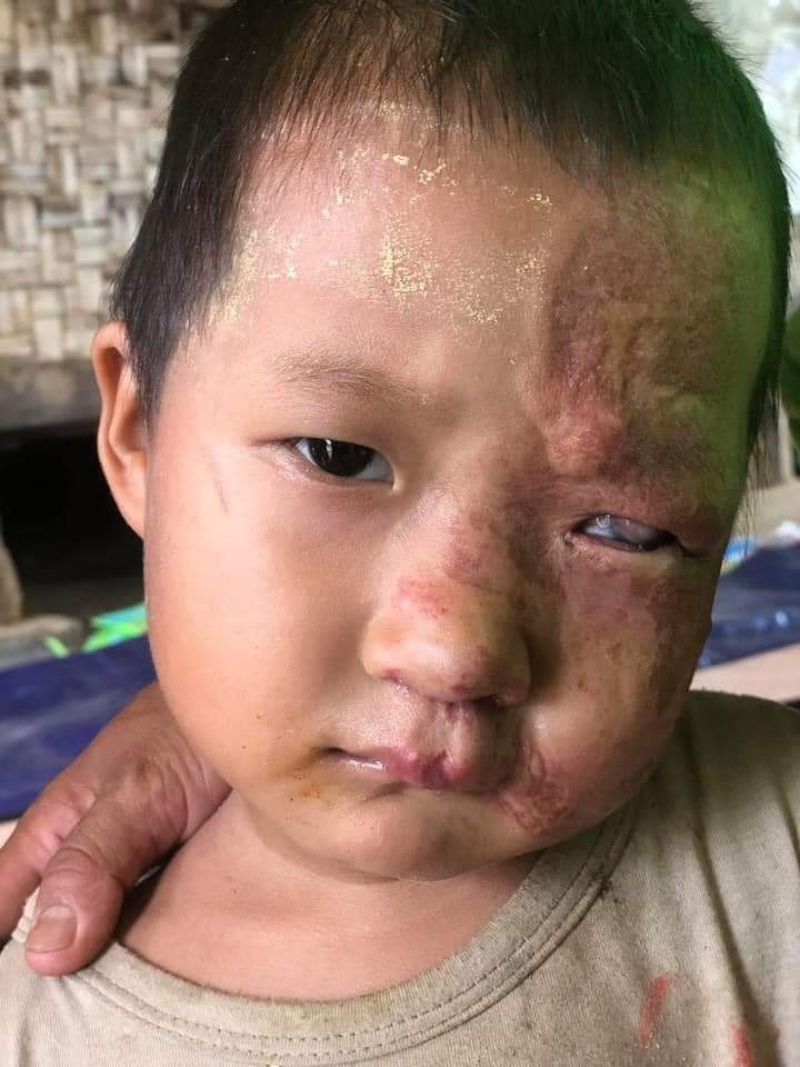 Khinnieoo's tweet photo. @Myanmar_Now_Eng #SaveMindat 
We need your help!!
မင်းတပ်မြို့လေးကိုကူညီပေးကြပါ😭 https://t.co/1D5TLVoMqm