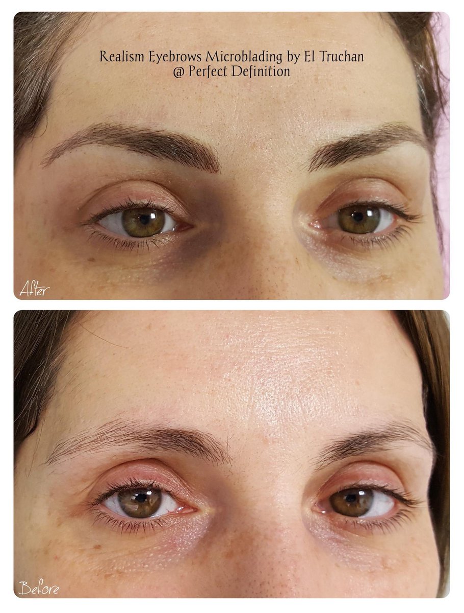 ElTruchan's tweet image. Realism Eyebrows Microblading by El Truchan @ Perfect Definition 

#permanenteyebrowtattoo #digitalmicroblading #hairstrokes #browqueen #browformation #nanoblading #nano-blading #microfeathering #microshading #kbpro  #completeyebrows