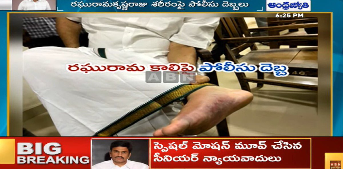 GangadharThati's tweet photo. This is the situation of a MP (@RaghuRaju_MP ) in Andhra Pradesh for criticising government incompetence..at least now please respond on these atrocities and abusing of power @ombirlakota https://t.co/ONWIyvywcC