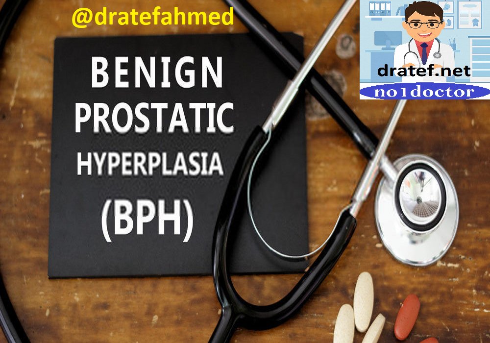 DrATEFAHMED's tweet photo. #Benign #Prostatic #Hyperplasia ( #BPH ) / #Enlarged #Prostate / #Prostate_Cancer / #Medical_Case #Discussion
https://t.co/630C8LnsBN
https://t.co/qEcZ77wppK
#prostatecancer #prostatesurgery #prostateexercises #prostatecancerfoundation #prostatediseasetreatment #prostateenlarge https://t.co/i4g6v1roj6