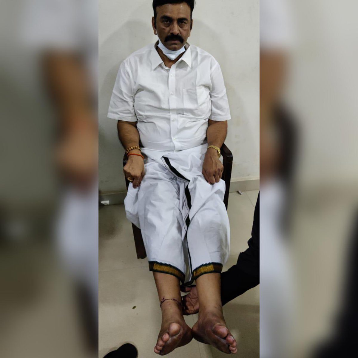 somuveerraju's tweet photo. రాష్ట్ర పోలీసు కస్టడీలో తీవ్రంగా గాయపడిన పార్లమెంటు సభ్యుడు @RaghuRaju_MP గారి చిత్రాలు కలతపెట్టేవి మరియు ఖ���డించదగినవి. ఇది మానవ హక్కుల ఉల్లంఘన. పార్లమెంటు సభ్యుడిని ఈ విధంగా రాష్ట్ర పోలీసులు వేధించగలిగితే, రాష్ట్రంలోని సాధారణ ప్రజల స్థితి ఏమిటి? (1/3) https://t.co/kWvyrnrRCr