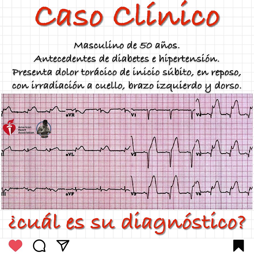 doccardenasc's tweet photo. 🧔🏻Signos vitales:
TA: 92/78, TAM 83, FR 32, Sat 88%, T 35 grados centígrados, Glasgow 13/15, Glucometria 382.
—
#DocCardenas #intensivista #covid19 #medicinacritica #diplomadoUCI #criticalcaremedicine #cardiologia #infectologia #anestesia #pocus #fccs @butterfly https://t.co/syXKjLB50J