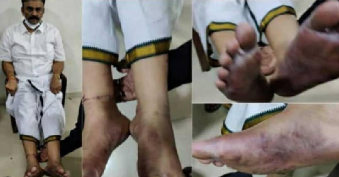 IParitalaSriram's tweet photo. (1/2)Absolutely condemning these barbaric acts of AP government.People may disagree,criticise,express disappointment or question when any government does not function the way it should.That does not mean you attack them so desperately.
#WeAreWithRRR 
#WeStandWithRRR https://t.co/ZVOkBR546z