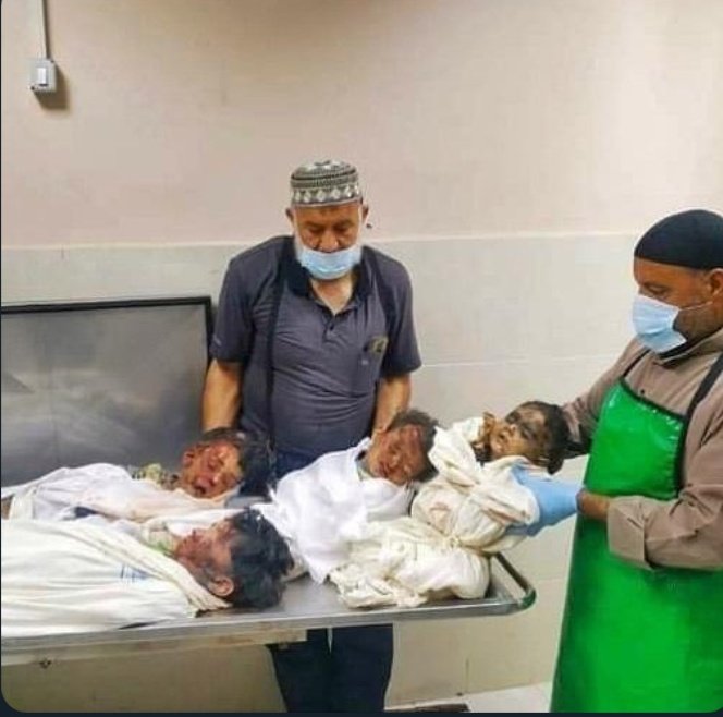 Simply, #Israeli kills and targets children, women and civilians
Look One of the pictures about the ugliness of Israel in Gaza👇💔

#GazzaUnderAttack
#GenocideinGaza #Gaza_Under_Attack #IsraelTerrorist  #IStandWithPalestine #IsraeliTerrorism #غزة_الآن #غزة_تحت_القصف_القدس_تنتفض