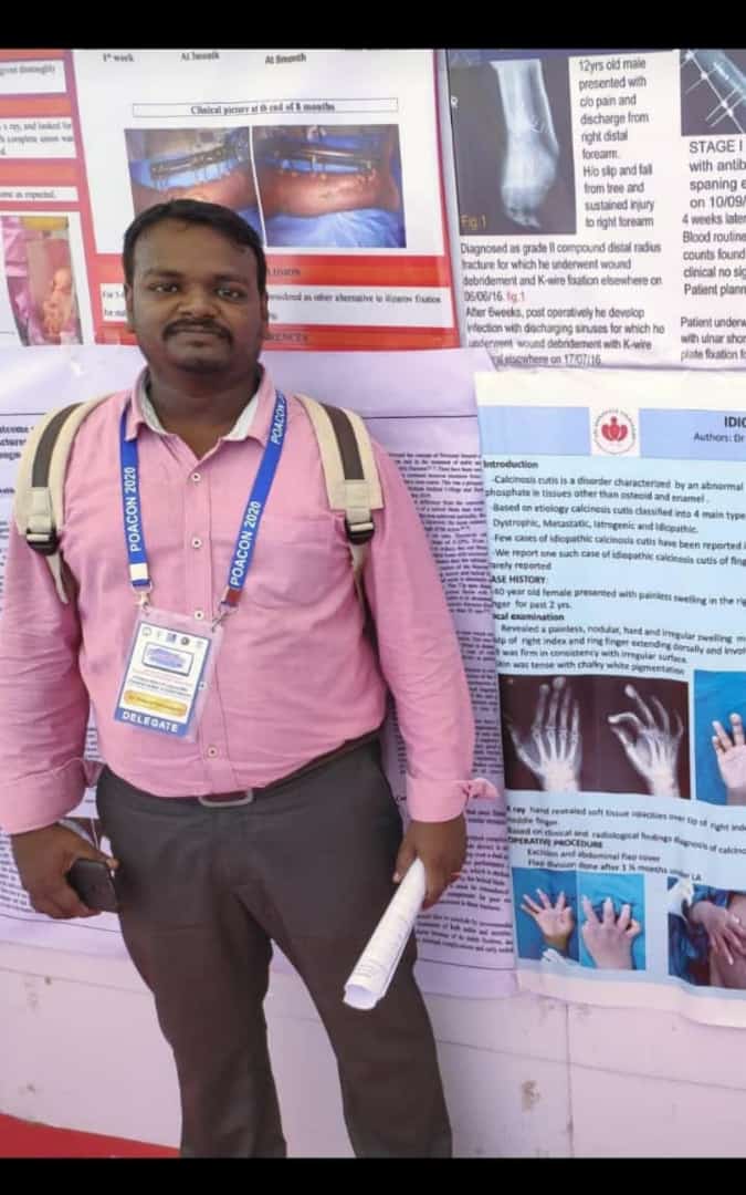 finalyrpgspdy's tweet photo. Bereaved by the loss of our own Dr.Diderot Paramaguru PG Resident Orthopaedics SMVMCH, died of Severe COVID on 4th May (1984-2021). You are a hero, you will live through your daughter who was born on same day you left. Good Bye.
#COVIDWarrior
#FoRDPU https://t.co/11ChdolXxo