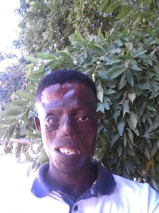 Rafael4Life_SA's tweet image. God bless Every1 who helps
Zero donations for Sicelos surgery &amp;amp; daily needs so far, please help him if you can deposit at least R10 into
His Absa Savings Acc: 9320525979

Retweet for awareness. We will donate R10 for every 10 Retweets non stop!
His story: Rafael4Life.co.za/Crowdfunding