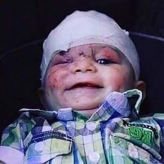 derradjihafid's tweet photo. صورة طفل فلسطيني أصيب البارحة في إحدى الغارات وهو يبتسم بشموخ وكبرياء ويقين بأنه سينتصر لوطنه يوما رغم الجراح والألام..
إنهم أطفال غزة العزة ، فما بالكم برجالهم ونسائهم.. https://t.co/Wohwak9zKh