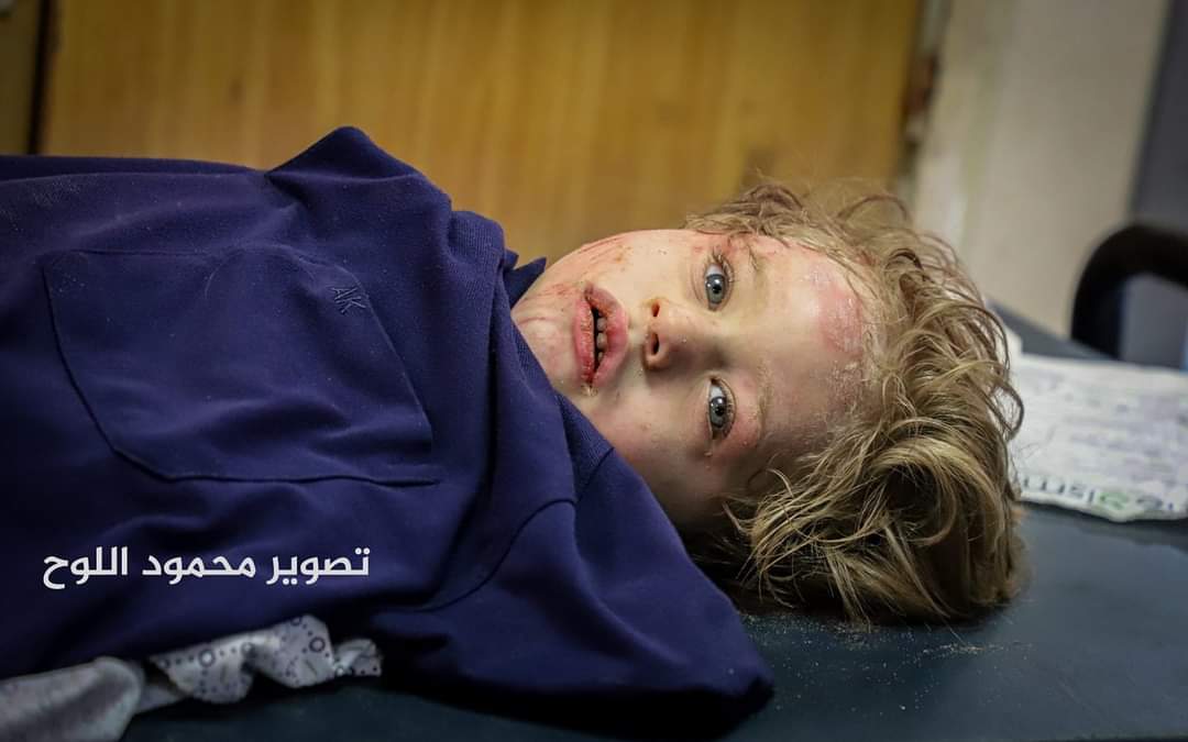 SHE5WN6ON's tweet photo. هذا الصغير يدعى "احمد محمد اليازجي"  ماتت أمه منذ سنتين اثناء الولادة نتيجة خطأ طبي، فتربى عند عمته من عائلة ابو العوف، عمته الان بحالة حرجه في المستشفى بعد قصف منزل عائلة أبو العوف واستشهاد كتير من أفرادها فجر اليوم، أي حياة يعيشها أحمد 💔 https://t.co/pfYVSTrWY3