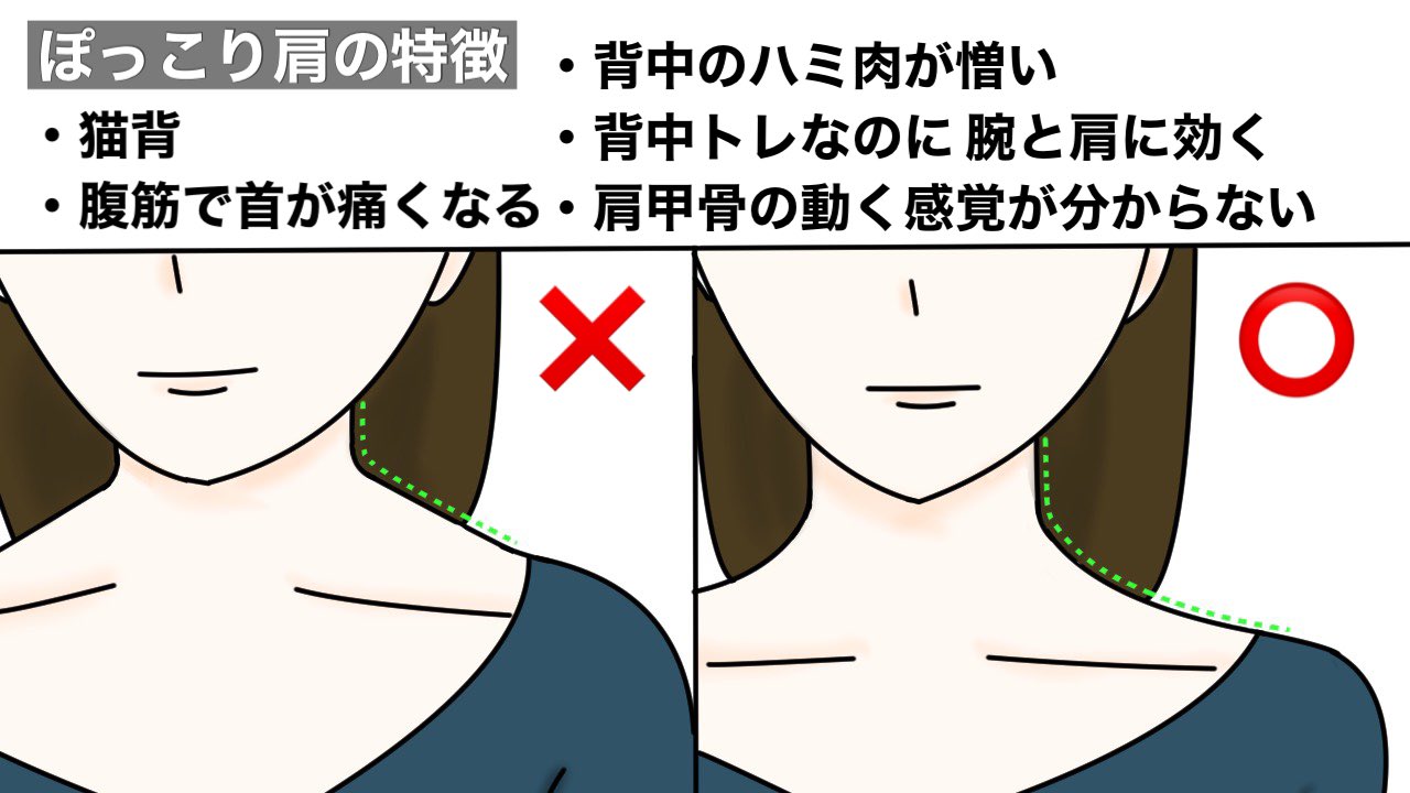 ユウトレ 膝パカ本 大好評発売中 肩がぽっこりしていて 上半身が強そうに見える 肩幅がガンダム と言われる人は 肩 甲骨のポジションが良くないかも この姿勢は常に肩に力が入り 呼吸が浅くなる その結果 上半身が華奢見えしない原因に 改善する