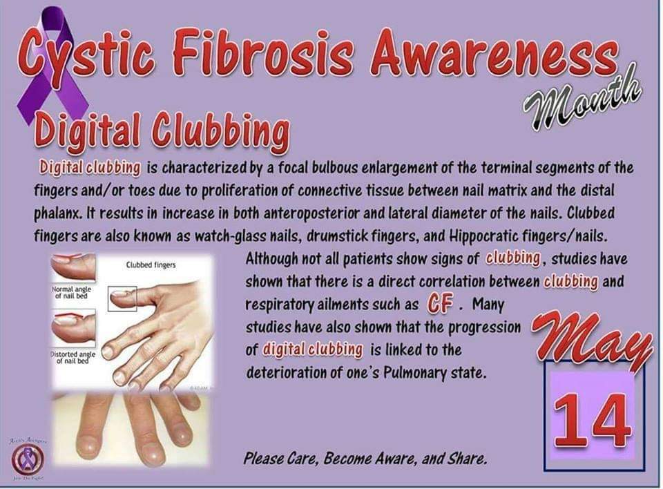 SNechvatal's tweet photo. #CFawareness month.
#65roses #cysticfibrosis #CFcantwait #aworldwithoutCF #notjustlungs #nodaysoff https://t.co/DeHV4NhWV2