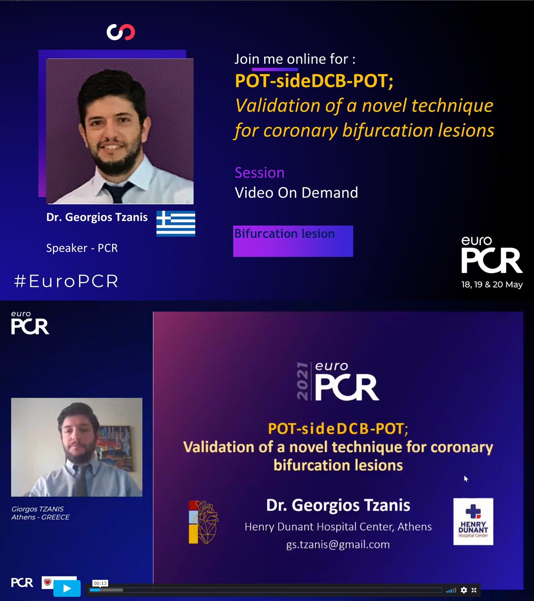 POT-sideDCB-POT. New technique for coronary bifurcation lessions presented at PCR.

#EuroPCR #PCRPresenter #CAD #bifurcation #PCI #cardiotwitter #EBC #innovation #DCB #DEB #DrugCoatedBalloon #esc2021 #ESC #InterventionalCardiology #Cardiology #PCRonline