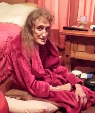 This is my mum a matter of weeks after her assessment, they stopped her benefits, took a month to respond to a ds1500, she died the same day. The assessor described her as slim build, she weighed 32kg, they fined her, tried to claw back overpayments, ignored doctor letters