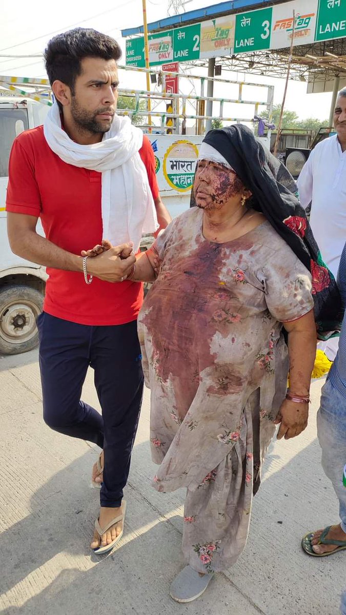 Tractor2twitr's tweet photo. Haryana Police on May 16 brutally cane charged, fired tear gas shells, pelted stones and even fired bullets at protesting farmers in Hisar.

Police did not even spare women. Many farmers were severely injured.

#खट्टर_सरकार_गुंडा_सरकार https://t.co/TrlBGChrdi
