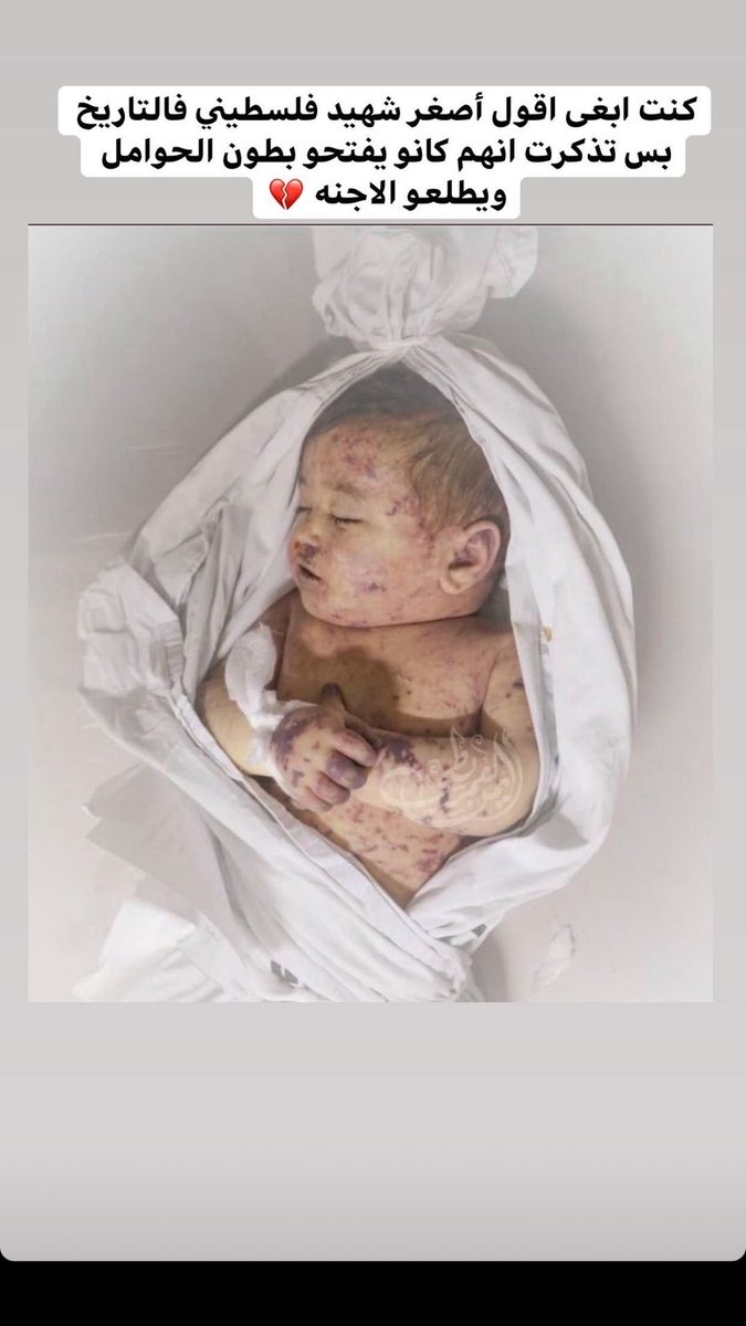 Bts0Fan0's tweet photo. Palestine is in danger. There are young children being bombed and dying. We in Palestine need your support for our cause so that we can take back our homes and lands and protect our children from the brutality of the Zionist occupier.
#FreePalaestine 
@BTS_twt 
@bts_bighit https://t.co/wB9WN51P1Z