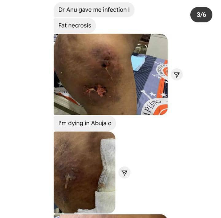 Naija_PR's tweet photo. Dr Anu has reportedly done it again o — Lady cries out after a supposedly Surgery went otherwise 1/2 https://t.co/AySy5rmTUn