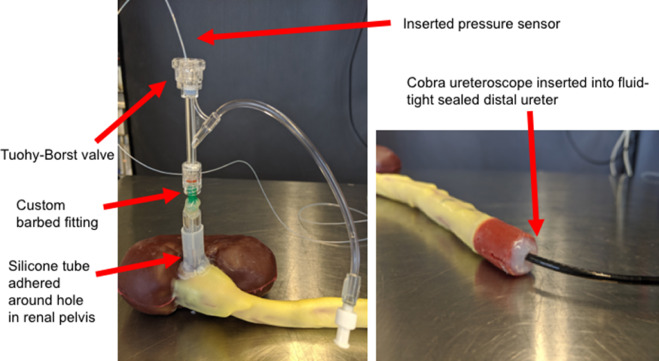 urogoldjournal's tweet photo. Researchers at U Michigan describe an anatomically accurate in vitro model for measuring intrapelvic pressure during ureteroscopy - a novel tool to test new technologies.

@AnujUPatel @MajdalanySami @Aldoukhi_Ali @peepeeDoctor 

@UMichUrology 

https://t.co/sp42xq5fmM https://t.co/ikz37gXSE8