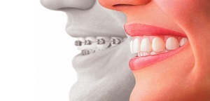 Advanced Dentistry 2021 will give dental undergraduates the latest information 
on the application process &amp; learn what to expect as a dental student 
and will also answer your questions. 
Book at frontiersmeetings.com/conferences/ad…
#dentistry #dentalcare #DENT #ucsfdentistry #ColumbiaCDM