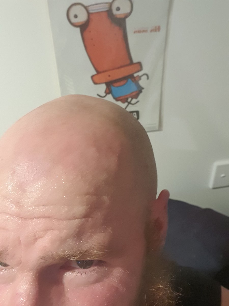 sigalasvacas's tweet photo. The kids are worried about the veins on my head post run... apparently they may explode #Fit4Farming https://t.co/HXqzejFesB
