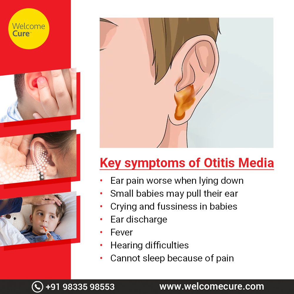 WelcomeCure's tweet photo. #KnowTheCondition
Otitis media refers to middle ear infection (area behind the eardrum) and is more common in kids.
#Earinfections #Acuteearinfection #Earpain https://t.co/hcQAoEUEy2