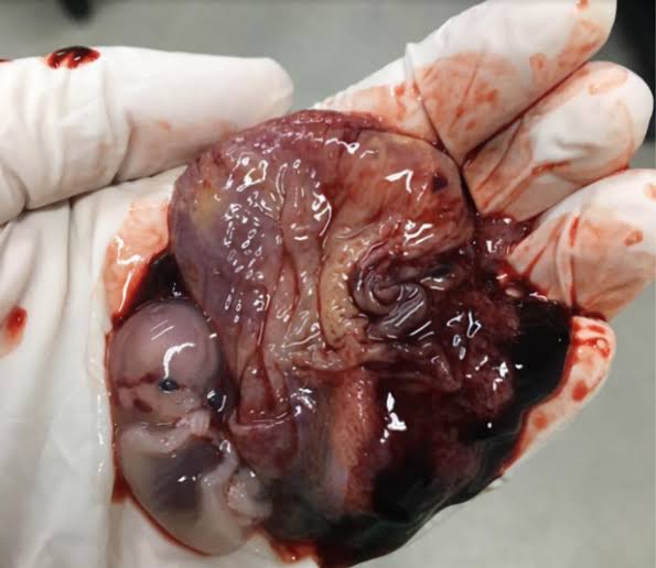 MyungOk10's tweet photo. As pessoas são a favor do aborto por que não é a cabeça delas que vai ser esmagada ou não são elas que vão ser trituradas até a morte só por que o "ser humano" não te quer. A vida só vai ser importante quando você sentir na pele oque é ser morta por não ser aceita pela sua "mãe". https://t.co/16YtJEXej6