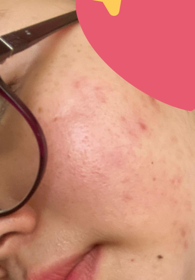 SyuhadaSuhain1's tweet photo. If you ask me if I want to repeat this skincare local or not, absolutely! See THE DIFFERENCES! 😩😍 I love it. 

I sell zarzou too, you can buy with me @skinexpertlab click link 
https://t.co/kQJ9XgLdSS https://t.co/QKIXvAgwtu