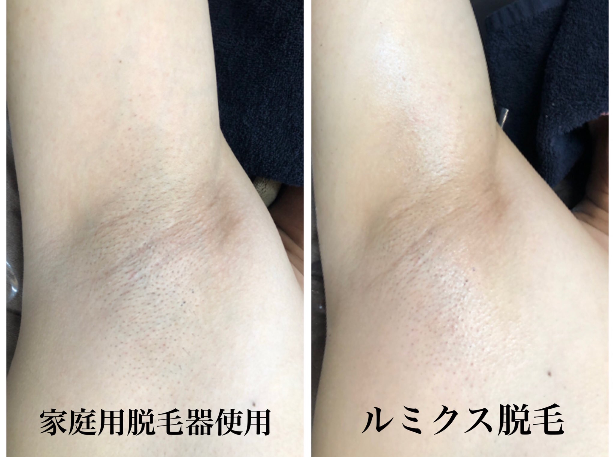 毛穴引き締め Twitter Search Twitter