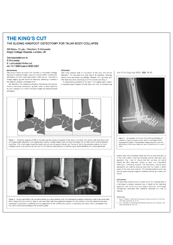 Tibiotalocalcaneal Arthrodesis Using a Nitinol Intramedullary Hindfoot Nail  - Andrew R. Hsu, J. Kent Ellington, Samuel B. Adams, 2015