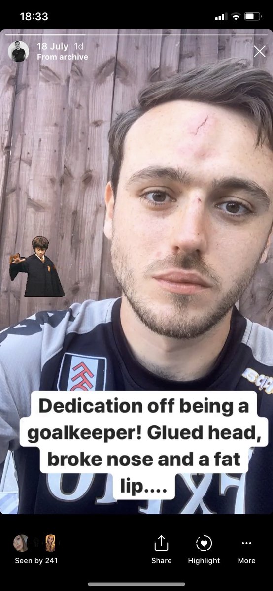 INJURIES - the worst set back anyone can have. Iv suffered fractures, breaks and dislocations, but nothing like this... whilst training in lockdown I collided with the post in an attempt to make a save, the post hit me straight down the centre of the face! 😬 it never stopped me