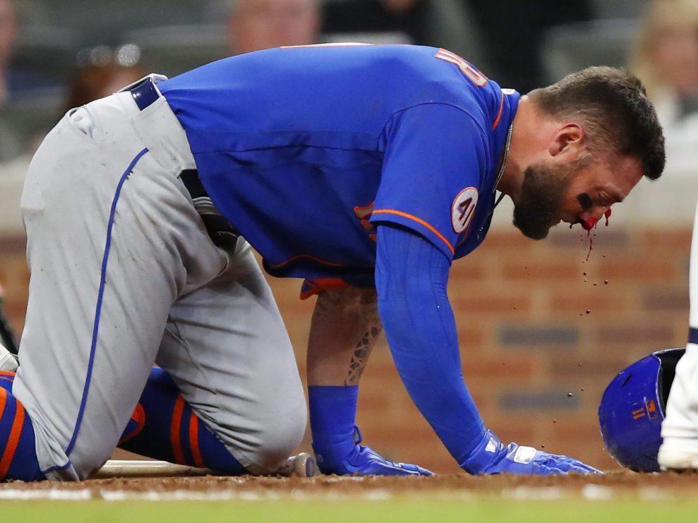Mets' Kevin Pillar exits after hit in face by pitch MLB