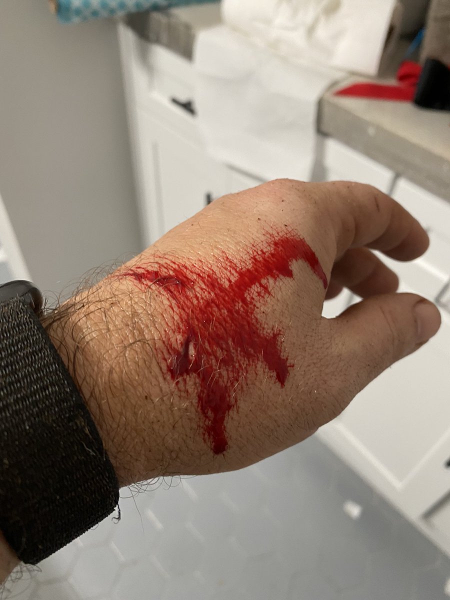 kevindando's tweet image. Apparently axes are stronger than hands.