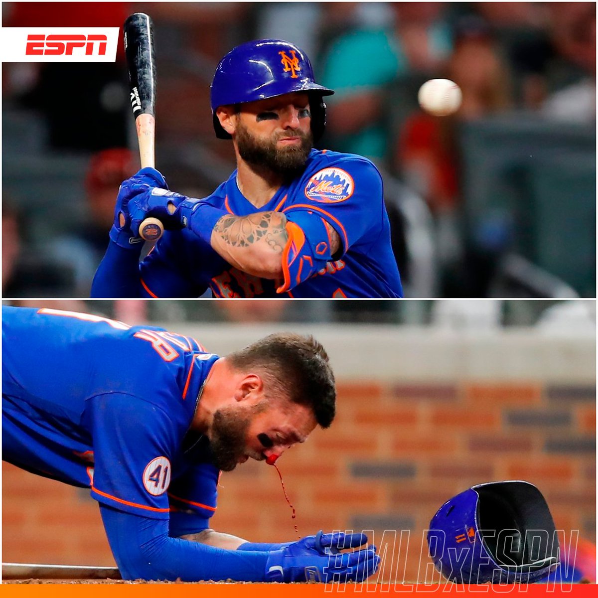 ESPNmx's tweet photo. Kevin Pillar SUFRIÓ tremendo golpe en la cara. 😱💥

Jacob Webb NO controló su lanzamiento y golpeó en el rostro al jardinero de los Mets. 

#MLBxESPN ⚾

https://t.co/IDfs2QX5B0 https://t.co/NcO1ShZlf3